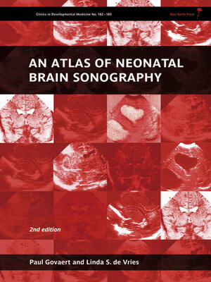 cover image of An Atlas of Neonatal Brain Sonography